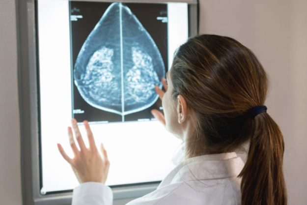 qualidade_na_imagem_radiolinea-732×488-1