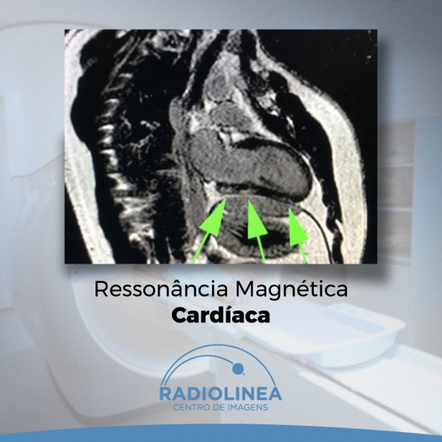 ressonancia-magnetica-cardiaca-radiolinea