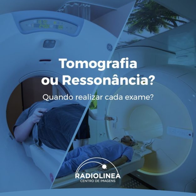 tomografia-ou-ressonancia-radiolinea Tomografia Ressonância