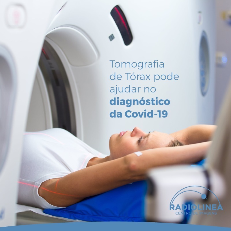 tomografia de tórax