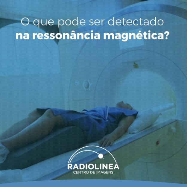 Ressonância-magnética-radiolinea-detectado Ressonância Magnética