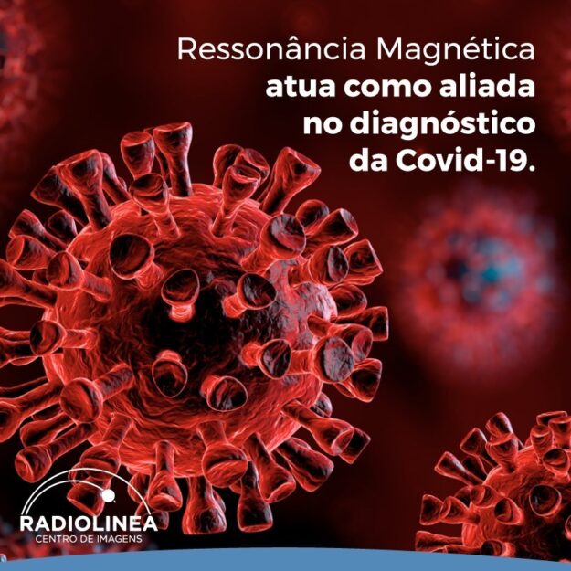 covid-19-ressonancia-magnetica covid-19 Ressonancia Magnetica