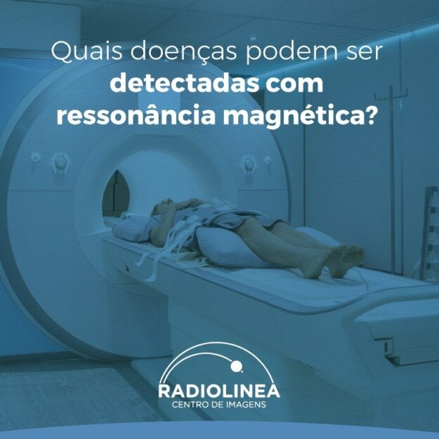 ressonancia-magnetica-doencas-radiolinea ressonância magnética