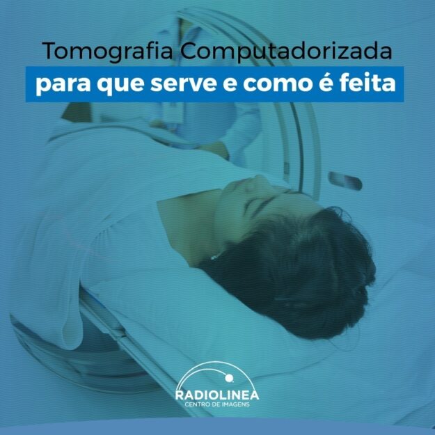 tomografia-computadorizada-site Tomografia Computadorizada