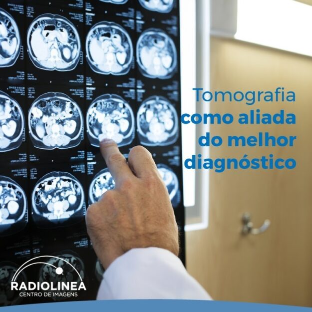 tomografia-radiolinea-diagnostico