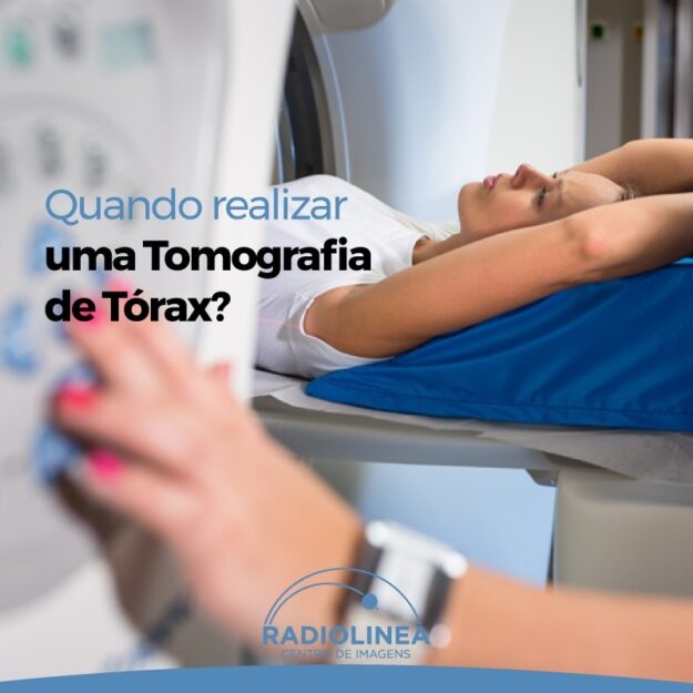 tomografia-de-torax Tomografia de Tórax