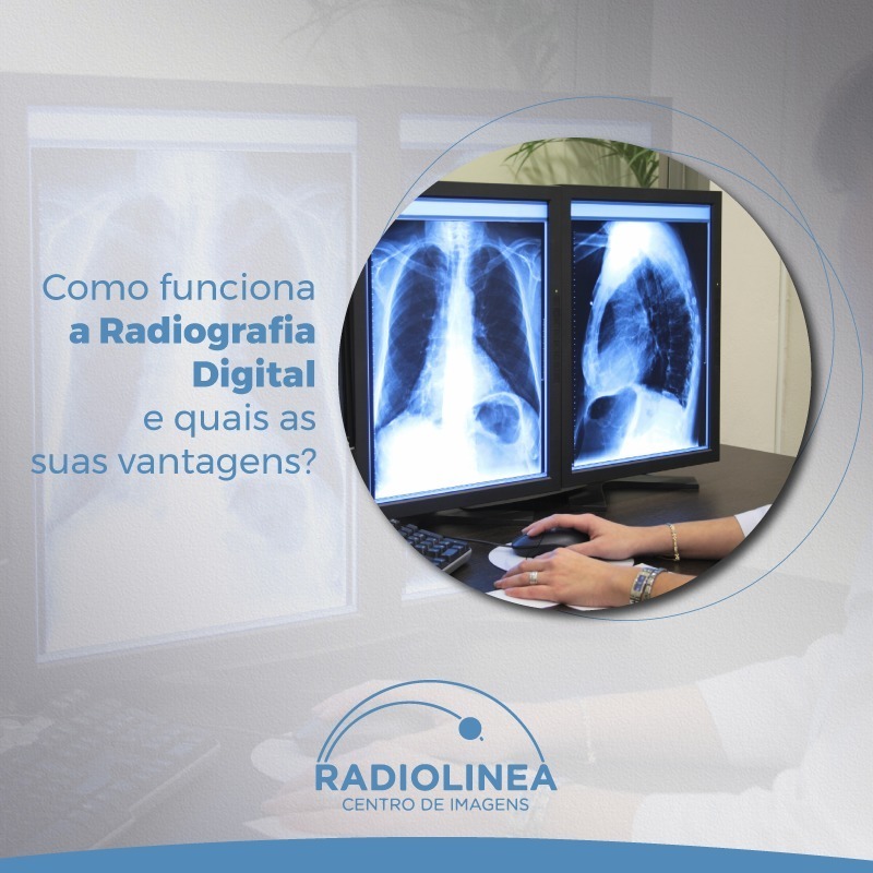 radiografia digital radiolinea