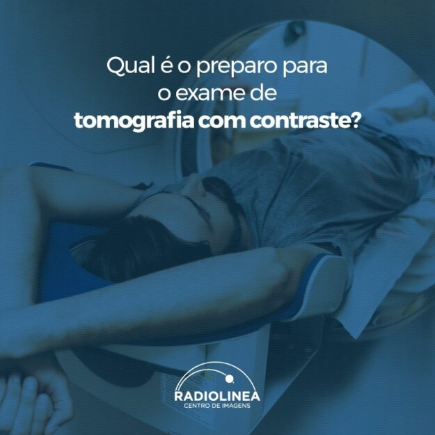 Tomografia Contraste Radiolinea