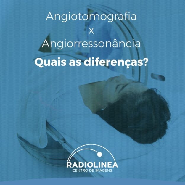 angio-angioressonancia-angiotomografia-radiolinea Angio Angiotomografia x angiorressonância