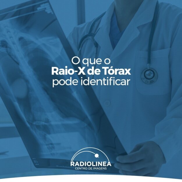 raio-x-de-torax Raio-x de Tórax