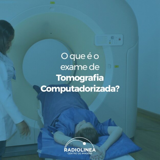 exame-de-ressonancia Exame de Tomografia