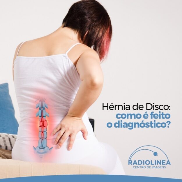 hernia-de-disco-radiolinea-site Hérnia de Disco Radiolinea