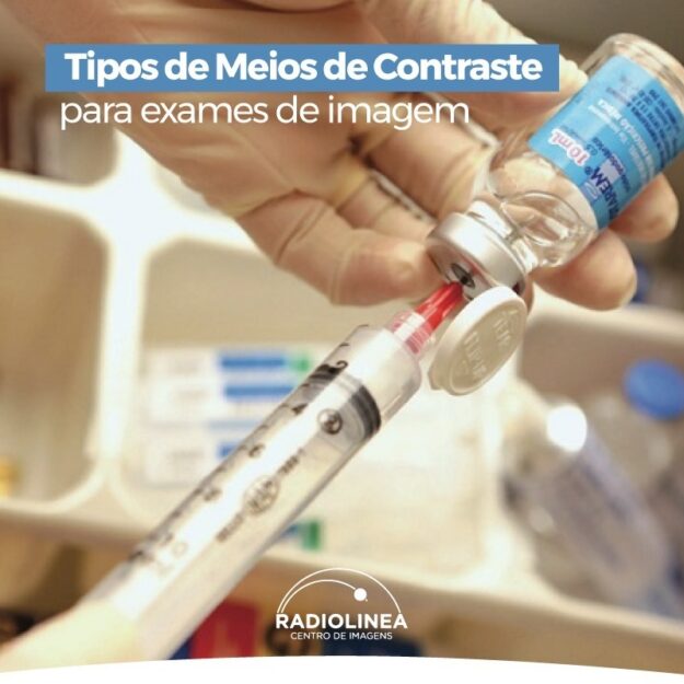 contraste-exames-radiolinea Contraste radiolinea