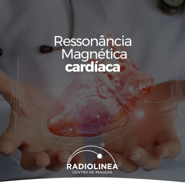 ressonancia-magnetica-cardiaca-radiolinea-site Ressonância Magnética Cardíaca Radiolinea