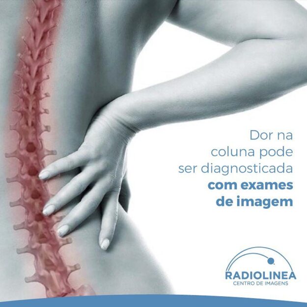 radiolinea-dor-na-coluna-exames-imagem Dor na coluna Radiolinea exames de imagem