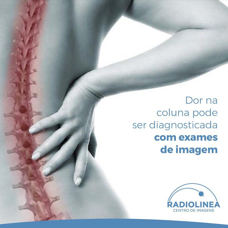 radiolinea-dor-na-coluna-exames-imagem Dor na coluna Radiolinea exames de imagem