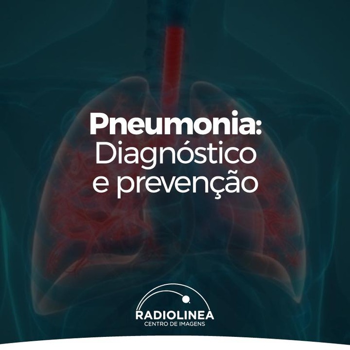 Pneumonia Radiolinea