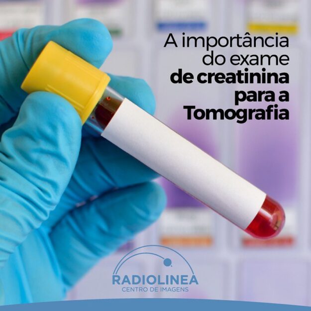 creatinina-radiolinea Creatinina Radiolinea