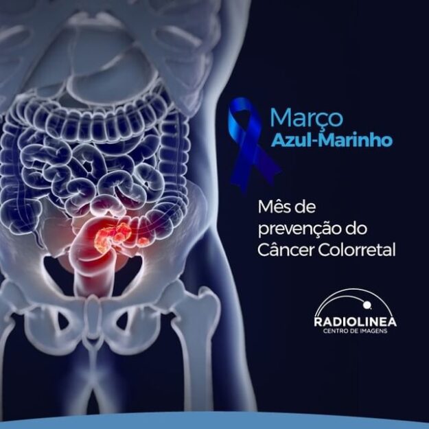 março-azul-marinho-cancer-colorretal Março Azul-Marinho Câncer Colorretal