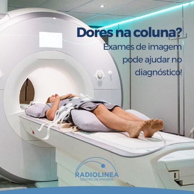 dores-na-coluna-radiolinea-ressonancia Dores na coluna Ressonância Radiolinea Exames de iamgem