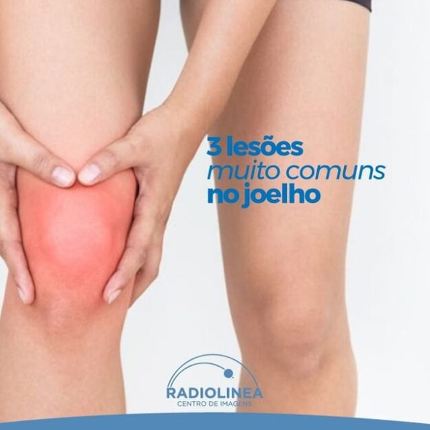 lesoes-joelho lesões no joelho comuns radiolinea