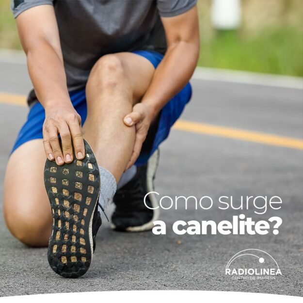 canelite-radiolinea Canelite Radiolinea Imagens Médicas