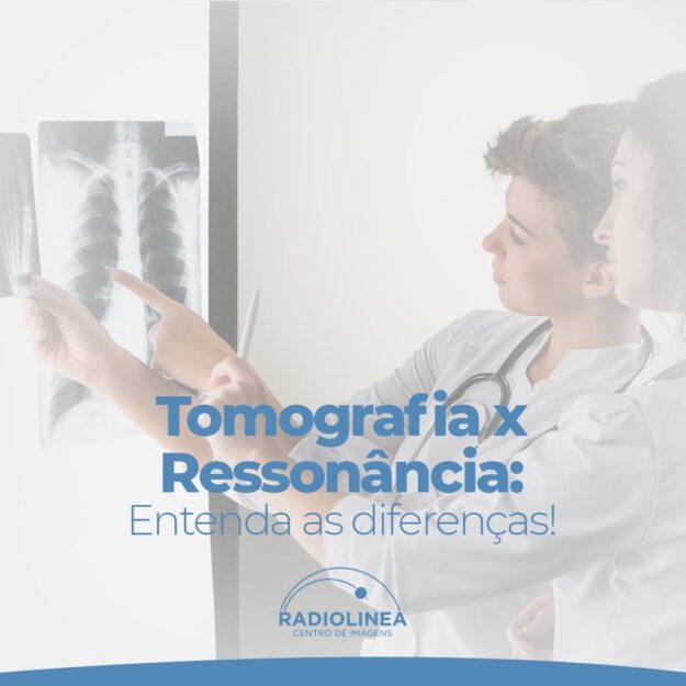 tomografia-x-ressonancia-radiolinea Tomografia x Ressonância Radiolinea