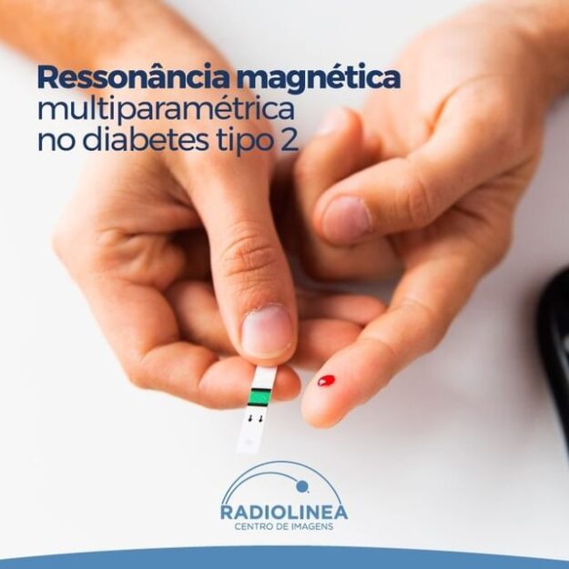 diabetes-tipo-2-ressonância-magnetica Diabetes Tipo 2 Radiolinea Ressonância Magnética