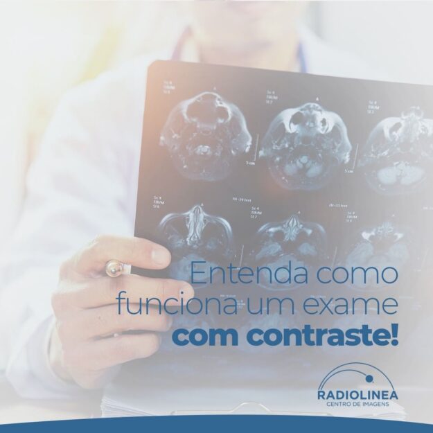 exame-contraste-radiolinea Radiolinea Exame com Contraste
