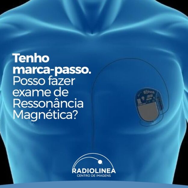 marca-passo-ressonancia-magnetica-radiolinea marca-passo Ressonância Magnética Radiolinea